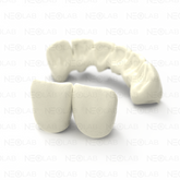 Crown Try-in mSLA 3D Print